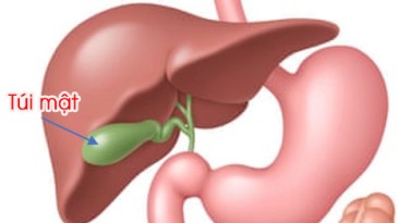 Polyp túi mật là bệnh gì và có cần phải điều trị không?